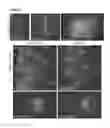 Fig. 21 - ETS factors regulate neural stem cell depletion and gliogenesis in Ras pathway glioma