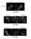 Fig. 10 - USP30 INHIBITORS AND METHODS OF USE