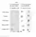 Fig. 09 - Rapid identification of microorganisms