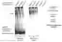 Fig. 01 - METHODS FOR DETECTING ENHANCED NMDA RECEPTOR FUNCTION AND USES THEREOF