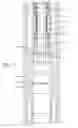 Fig. 06 - METHOD AND APPARATUS FOR TREATING A WELLBORE