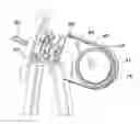 Fig. 01 - Valve With Removable Seat