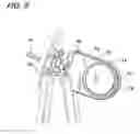 Fig. 07 - Valve With Removable Seat