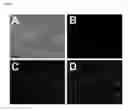 Fig. 09 - Method for the rapid and convenient detection and enumeration of neutrophils in biological samples