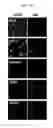 Fig. 02 - Method for producing antigen specific monoclonal antibody