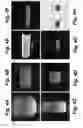 Fig. 05 - MRI RF pulse sequence for multidimensional outer volume suppression
