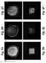 Fig. 06 - MRI RF pulse sequence for multidimensional outer volume suppression