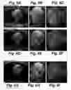 Fig. 07 - MRI RF pulse sequence for multidimensional outer volume suppression