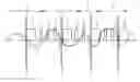 Fig. 01 - Recording a magnetic resonance data set
