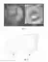Fig. 06 - MECHANICAL ACTUATOR AND A METHOD FOR MAGNETIC RESONANCE ELASTOGRAPHY USING CENTRIFUGAL FORCE