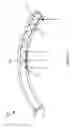 Fig. 07 - SYSTEMS, DEVICES, AND METHODS FOR CURVED WAVEGUIDES INTEGRATED WITH CURVED EYEGLASS LENSES