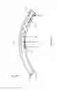 Fig. 07 - Systems, devices, and methods for curved waveguides integrated with curved eyeglass lenses