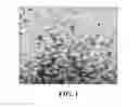 Fig. 02 - Speckle reduction instrument