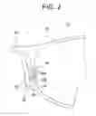 Fig. 03 - Nose pad and eyeglasses provided with the pad