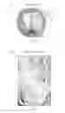 Fig. 09 - Virtual reality systems and methods for improving clinical outcomes