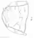 Fig. 04 - Method of manufacturing prosthetic socket interface