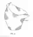 Fig. 12 - Method of manufacturing prosthetic socket interface