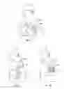 Fig. 19 - Method of manufacturing prosthetic socket interface