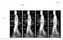 Fig. 01 - Moving part image partitioning for walking gait identification