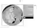 Fig. 01 - Medical image classification apparatus, method, and program
