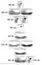 Fig. 07 - Method for artifact reduction using monoenergetic data in computed tomography