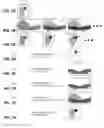 Fig. 08 - Method for artifact reduction using monoenergetic data in computed tomography