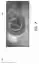 Fig. 06 - RECONSTRUCTION OF THREE DIMENSIONAL MODEL OF AN OBJECT COMPENSATING FOR OBJECT ORIENTATION CHANGES BETWEEN SURFACE OR SLICE SCANS