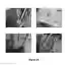 Fig. 37 - Electrochemical systems with ionically conductive and electronically insulating separator