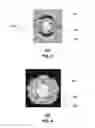 Fig. 03 - Method and apparatus for providing security using network traffic adjustments