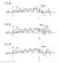 Fig. 04 - Actuator driver, imaging device using the same, and imaging method