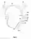 Fig. 02 - Headset with external speakers