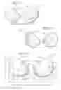 Fig. 02 - Breast supporting devices and methods