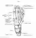 Fig. 02 - CORRECTIVE INSOLE