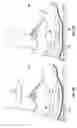 Fig. 08 - Rocker shoes, rocker shoe development kit and method