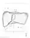 Fig. 06 - Convertible bullet-proof backpack