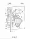 Fig. 08 - Method for observing the branch portion of the hole and method for operating the endoscope system