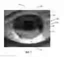 Fig. 08 - Ocular surface interferometry (OSI) devices and systems for imaging, processing, and/or displaying an ocular tear film