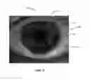 Fig. 09 - Ocular surface interferometry (OSI) devices and systems for imaging, processing, and/or displaying an ocular tear film