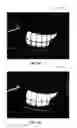 Fig. 28 - Ocular surface interferometry (OSI) devices and systems for imaging, processing, and/or displaying an ocular tear film