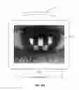 Fig. 35 - Ocular surface interferometry (OSI) devices and systems for imaging, processing, and/or displaying an ocular tear film