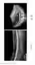 Fig. 06 - Systems and methods for long working distance optical coherence tomography (OCT)