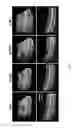 Fig. 07 - Systems and methods for long working distance optical coherence tomography (OCT)
