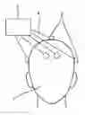 Fig. 01 - Detection of the heartbeat in cranial accelerometer data using independent component analysis