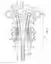 Fig. 12 - Catheter with multi-functional control handle having rotational mechanism