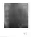 Fig. 10 - Automatically determining 3D catheter location and orientation using 2D fluoroscopy only