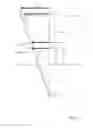 Fig. 11 - Automatically determining 3D catheter location and orientation using 2D fluoroscopy only