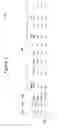 Fig. 03 - Pattern recognition system for quantifying the likelihood of the contribution of multiple possible forms of chronic disease to patient reported dyspnea