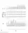 Fig. 12 - Pattern recognition system for quantifying the likelihood of the contribution of multiple possible forms of chronic disease to patient reported dyspnea