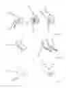 Fig. 03 - ACTIVE ORTHOSIS SYSTEM