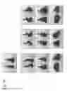 Fig. 16 - Hair diameter measurement